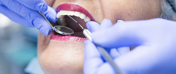 Best Emergency Broken Tooth Repair in Hayden, ID